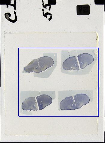 Media type: image; Special Collections 3298   shows specimen_part histological serial section;